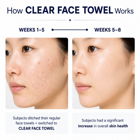 Face Towels Disposable XL,Acne Fighting Biodegradable Face Towel, Ultra Soft for Sensitive Skin, Eco-Friendly Facial Towels for Cleansing & Drying